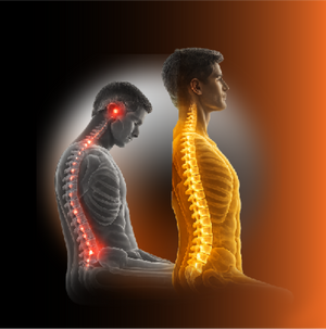 Posture Recovery