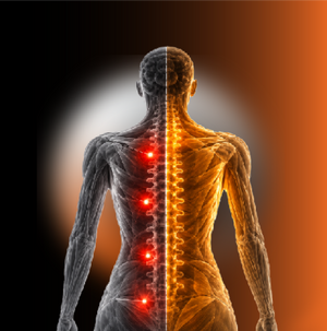 Back Recovery